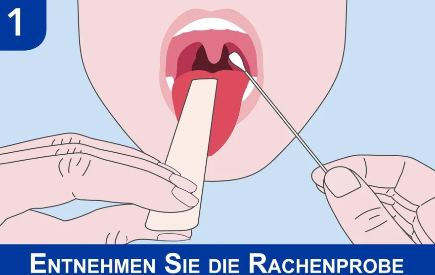 Halsschmerzen Heimtest 1 Stück - Streptokokken A Test für Zuhause