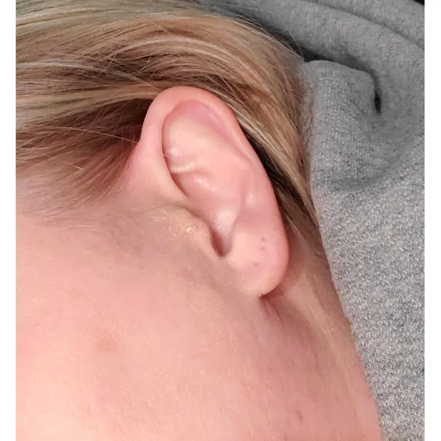 MODRSA 38tlg Klar Körperpiercing Set - Bauchnabel, Lippe, Nase, Augenbraue
